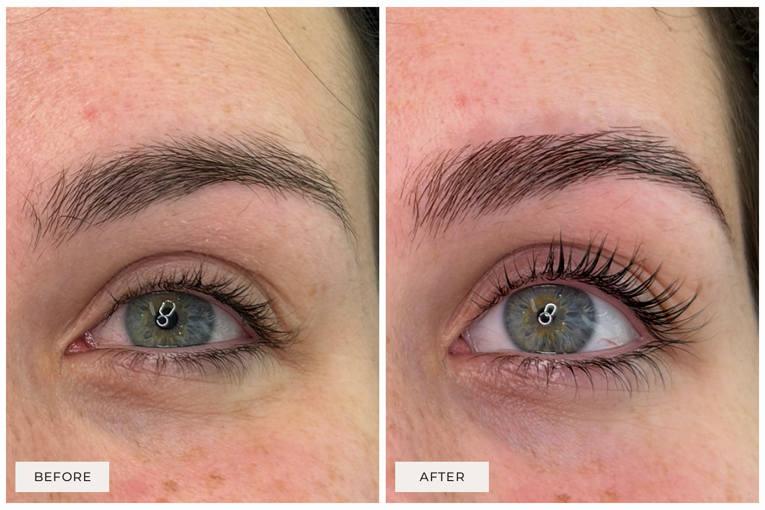 before and after lash
